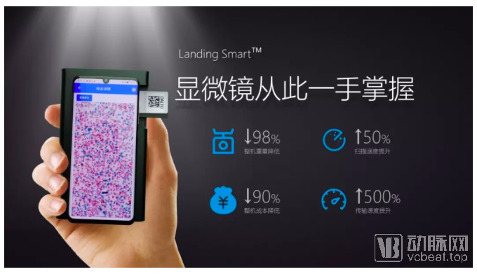 5G手机变身显微镜？兰丁视霸让数据随时皆可采集