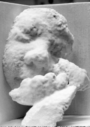英诊所为胎中宝宝塑像 3D绘出胎儿雏形