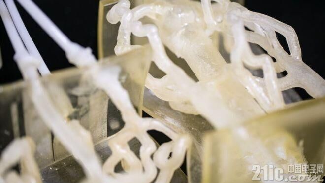 脑部手术成功实施 3D打印功不可没！