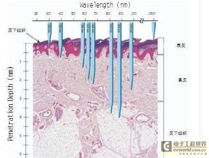 LED光源在皮肤医学中的应用