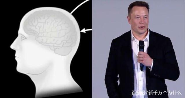 马斯克脑机技术开始试验 植入芯片可帮助脑与脊椎损伤者