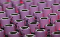 关于BMS技术在动力锂电池的作用解析