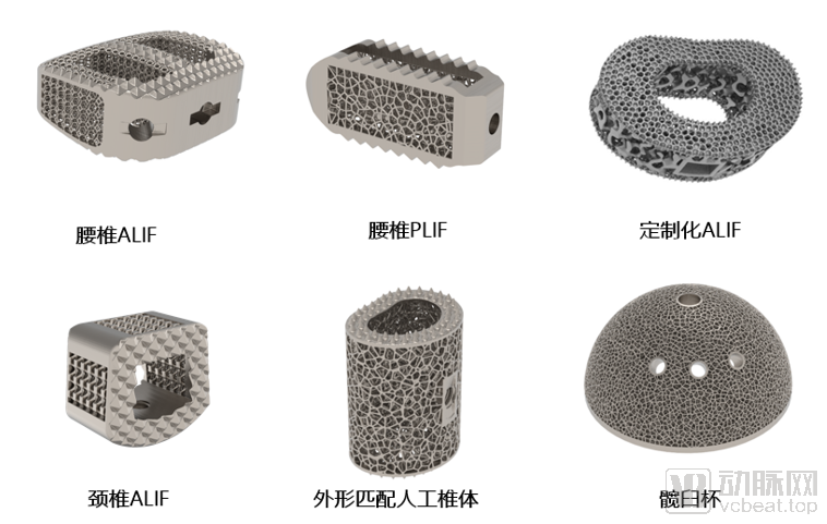 智塑健康的人造骨骼匹配之路：3D打印重构骨科植入体
