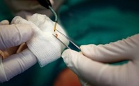 医疗保健中实施物联网系统的主要利弊是什么?