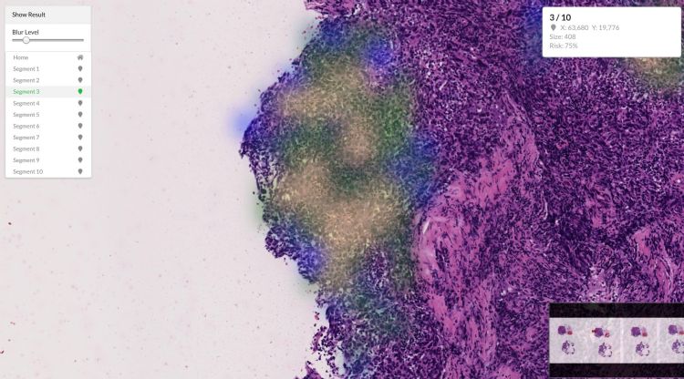 云象科技的AI医疗影像判读系统，获刊登於知名期刊Cancers。