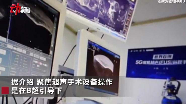 医生“隔空”做手术:世界首例5G聚焦超声手术完成