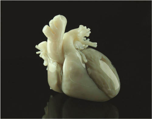 3D打印走进医学临床 “精准医疗”+“中国智造”双概念受资本热捧