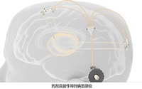 英国宣布一项医学研究里程碑, 3D打印推动帕金森症的研究