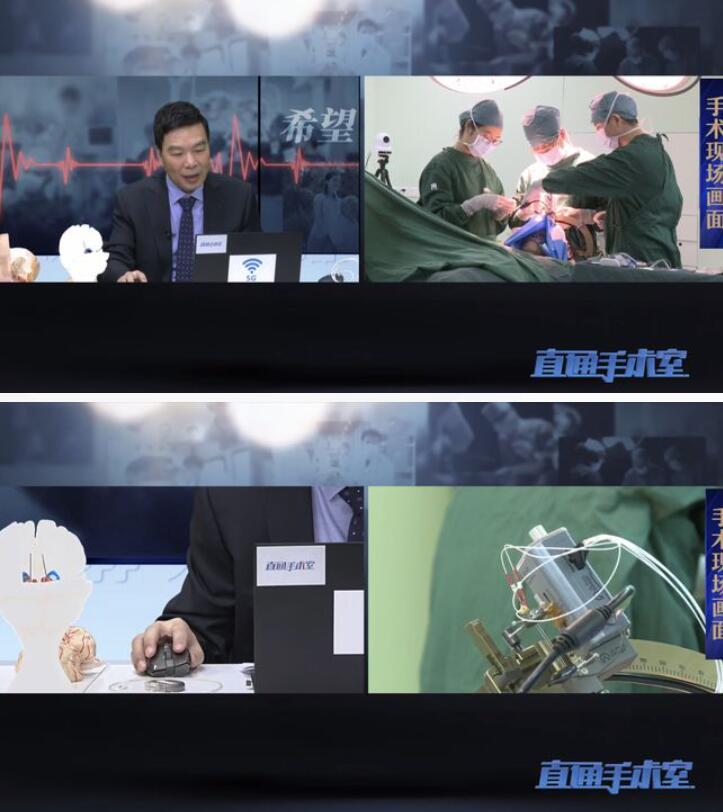三千公里5G远程手术 凌至培成功完成帕金森病脑起博器