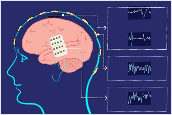 脑机结合时代正在到来人类文明进程将会加快