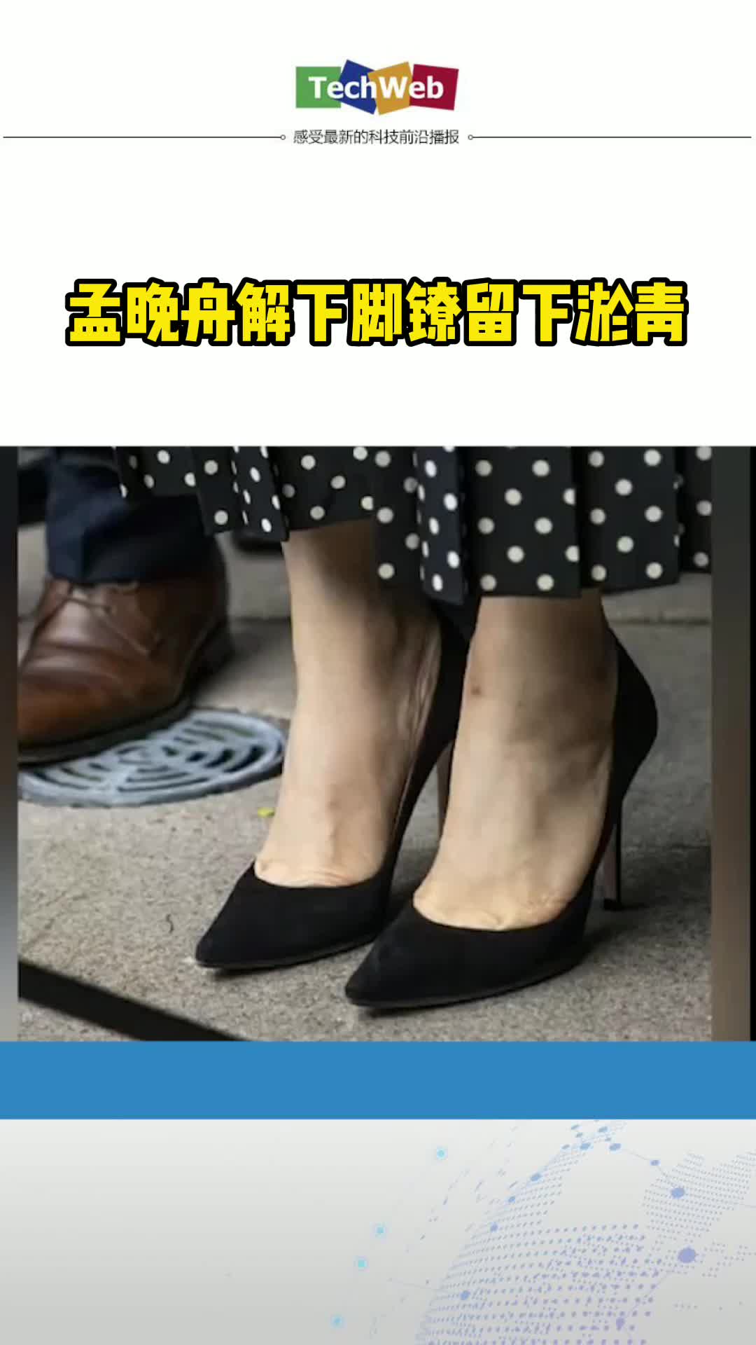 孟晚舟脚链被解除 留下淤青