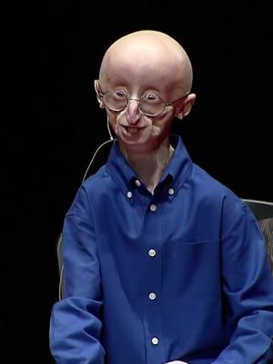 美国发现新疗法能治疗儿童早衰，进一步发展将延缓人类衰老
